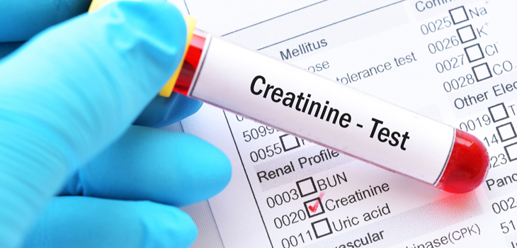 What is Creatinine? | Mehta Hospitals
