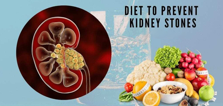 kidney diet