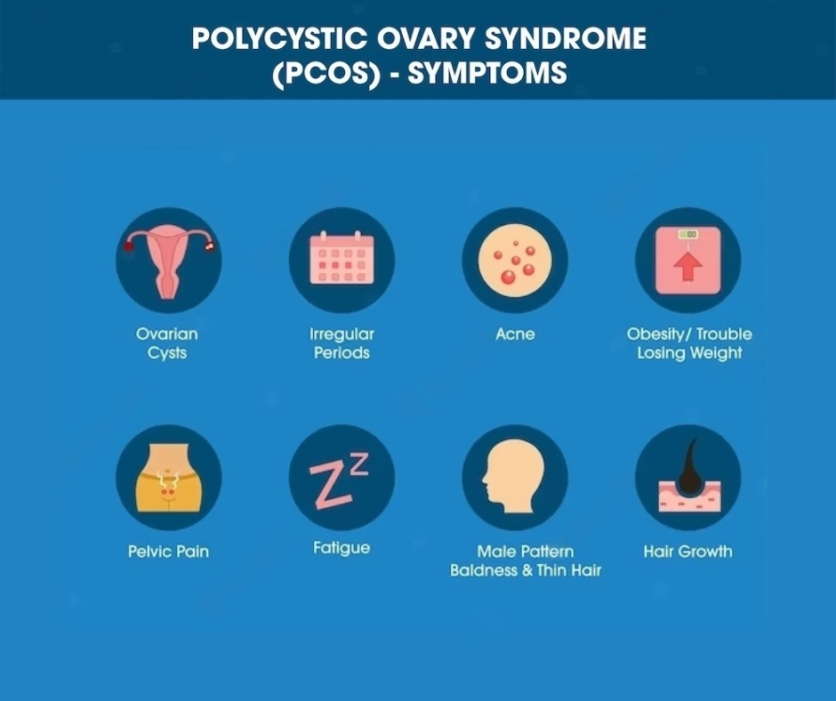 Tips For Working Women To Manage PCOS