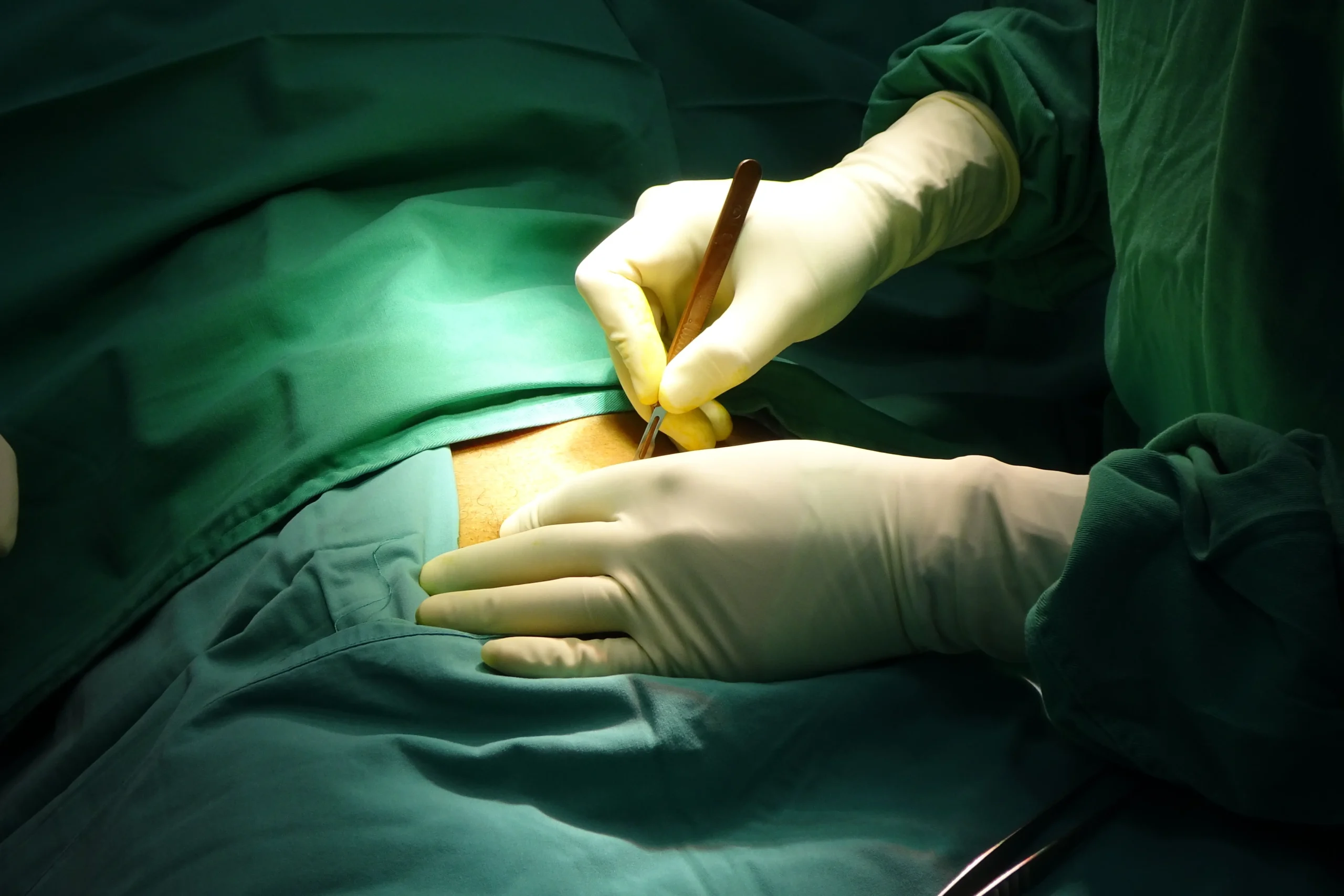 Doctors doing Surgery