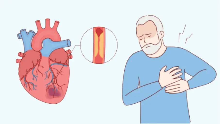 Heart attack vs heart palpination