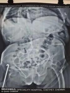 X-ray scan 