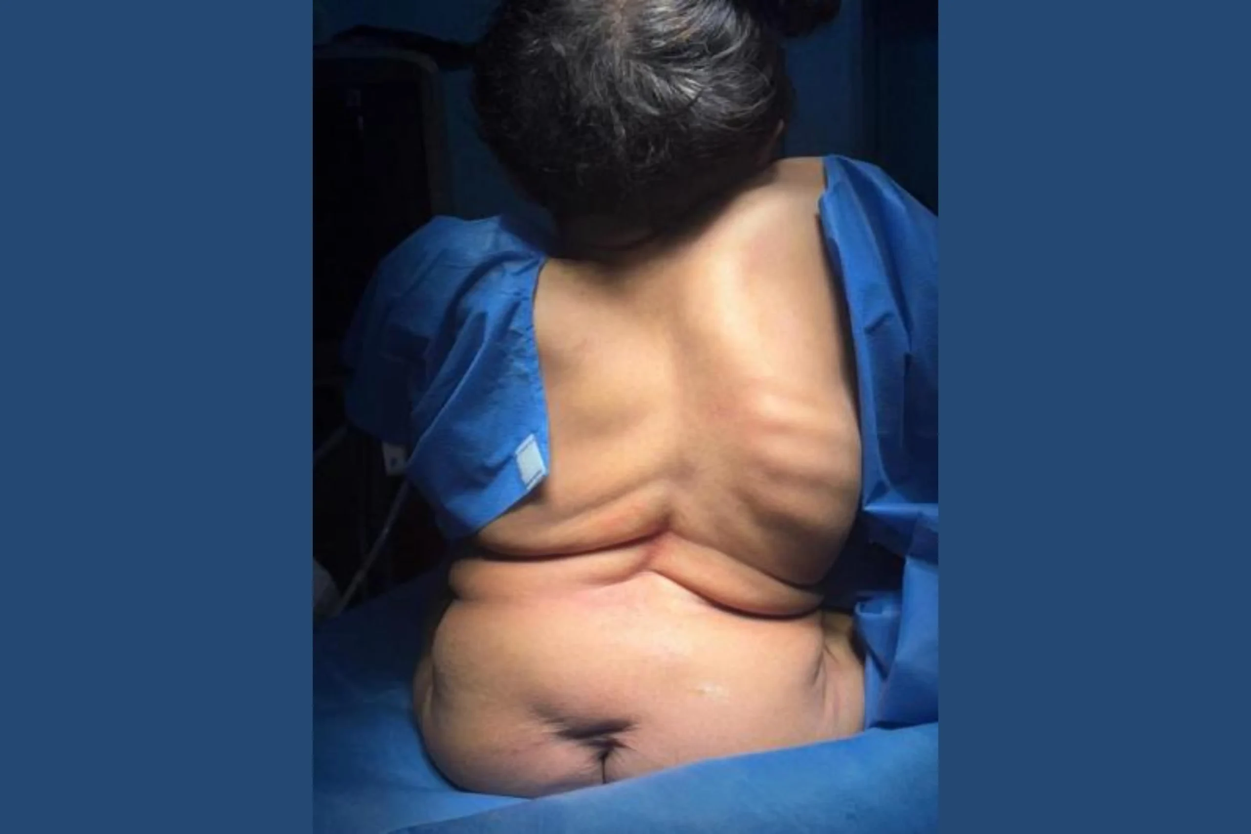 rare-surgery-1