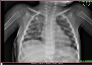 X-ray image of patients