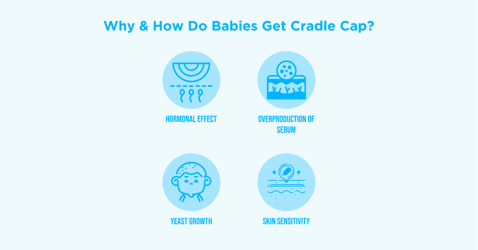 Infographic showing reasons why babies get cradle cap. Four icons with labels: Hormonal Effect, Overproduction of Sebum, Yeast Growth, and Skin Sensitivity, arranged in two rows