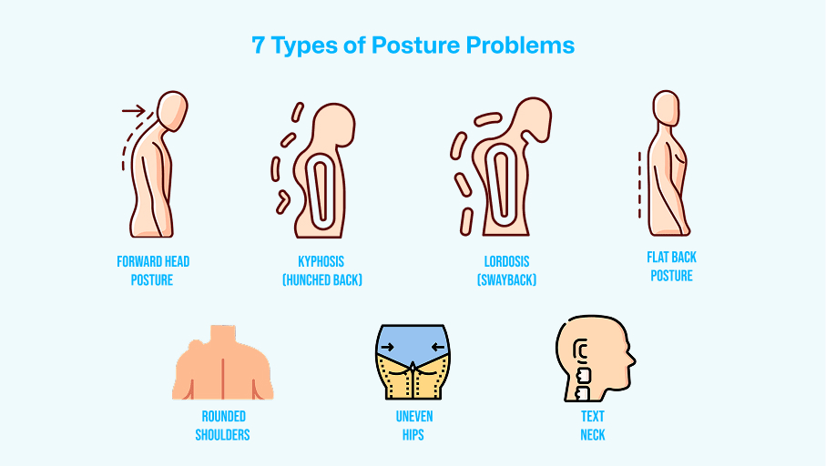 Illustration showing 7 types of posture problems including forward head posture, kyphosis (hunched back), lordosis (swayback), flat back posture, rounded shoulders, uneven hips, and text neck.