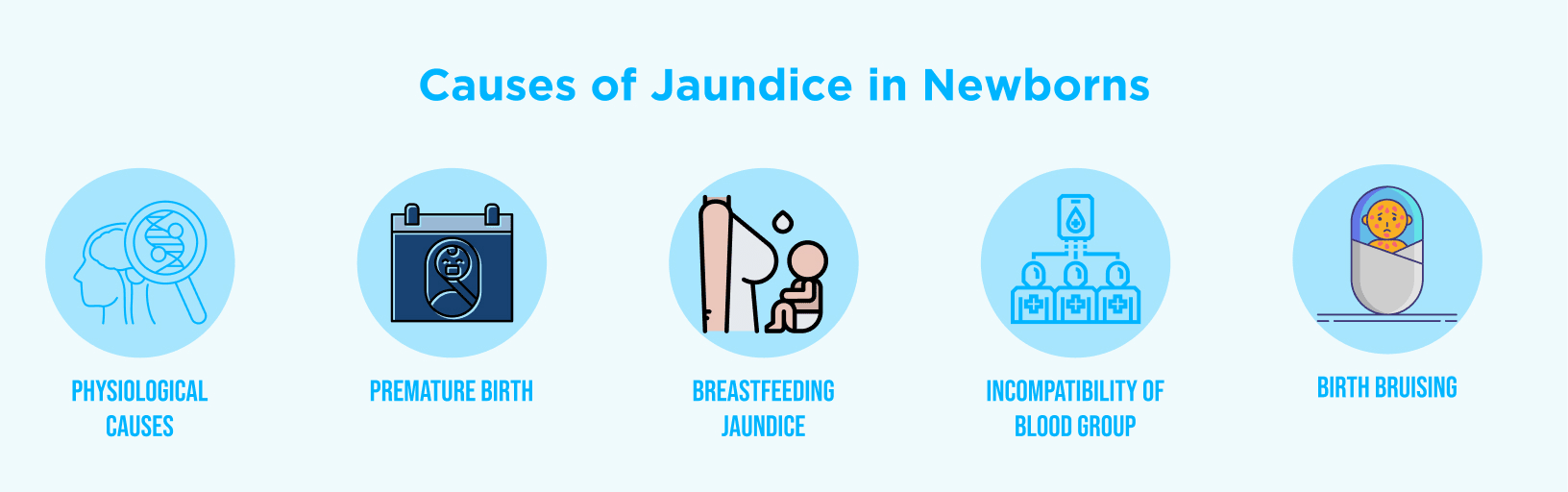 Infographic showing causes of jaundice in newborns – physiological causes, premature birth, breastfeeding jaundice, blood group incompatibility, and birth bruising.