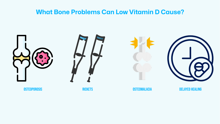 Illustration showing bone problems caused by low vitamin D, including osteoporosis, rickets, osteomalacia, and delayed healing.