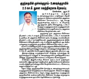 Child with Recurrent Tracheoesophageal Fistula Successfully Treated with 2.5 cm Reconstructive Surgery